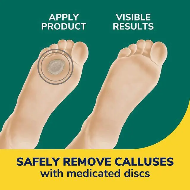 Alt view image 3 of 6 - Dr. Scholl's Extra Thick Callus Remover, 4ct // Helps Soften Hard Calluses and Cushions for All-Day Pain Relief (Pack of 2)