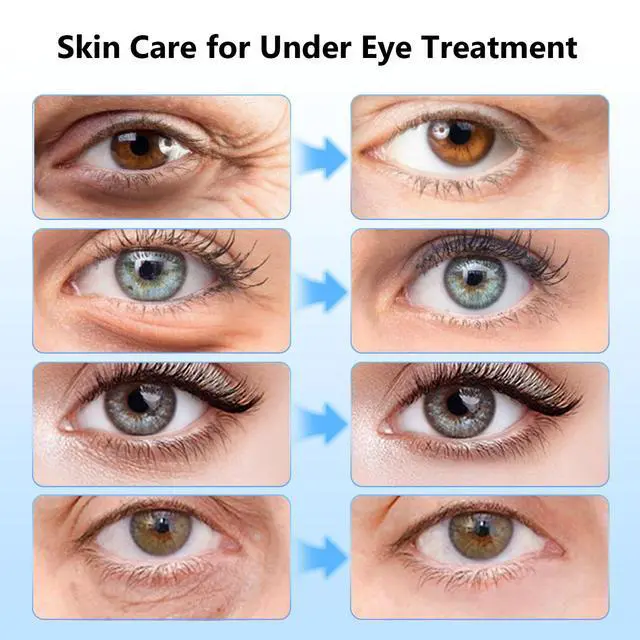 Alt view image 4 of 7 - Adofect Under Eye Patches 40 Pairs, Eye Masks with 24K Gold, Hyaluronic Acid, Caffeine & Retinol for Dark Circles, Puffy Eyes, Under Eye Bags, Skincare Gifts for Bachelorette Party Accessories