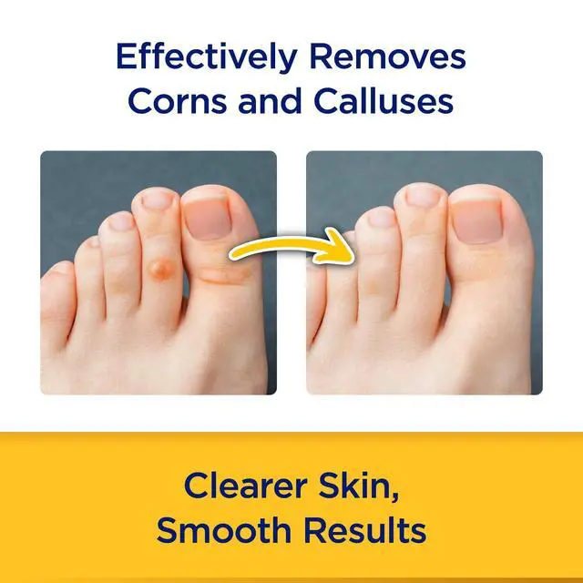 Alt view image 2 of 6 - CornStick Corn and Callus Remover, 0.2 Oz
