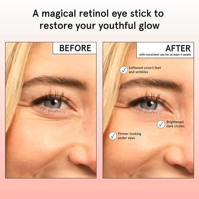 Alt view image 3 of 7 - grace & stella Under Eye Brightener Balm Stick - Travel Size Toiletries - Retinol & Caffeine Eye Cream for Dark Circles, Puffiness, Wrinkles - Restore and Hydrate - Vegan Skincare (0.13oz / 3.5g)