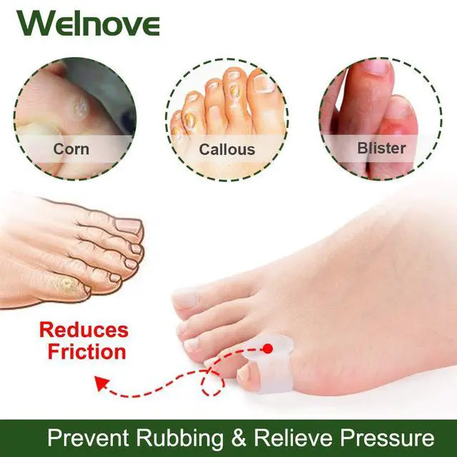 Alt view image 3 of 7 - Welnove Gel Toe Separator, Pinky Toe Spacers, Little Toe Cushions, Small Toe Sleeves for Preventing Rubbing & Reducing Pressure (Pack of 12, Transparent)