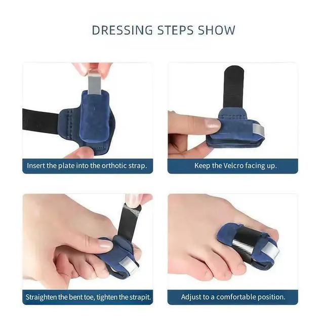 Alt view image 3 of 6 - Qintreesify 2 Pcs Small Toe Splints for Straightening Hammer Toe Corrector Toe Straightener Finger Support Brace Stabilizer Men Women Broken Support, Bunion Pads, Foot Health (Blue)