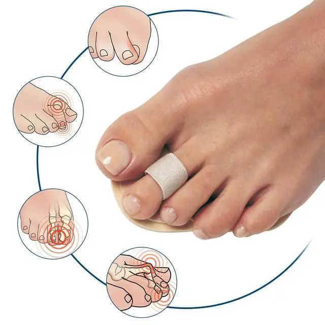 Alt view image 2 of 5 - Pedifix Budin Toe Straightener with Metatarsal Cushion Pad 1 Pack | Soft loop aligns crooked, overlapping or hammer toes, while the cushioned metatarsal pad relieves forefoot pressure.