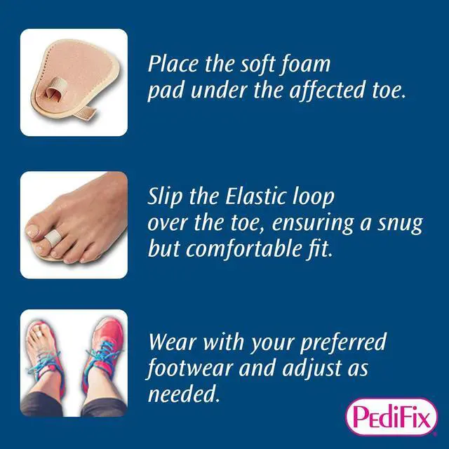 Alt view image 4 of 5 - Pedifix Budin Toe Straightener with Metatarsal Cushion Pad 1 Pack | Soft loop aligns crooked, overlapping or hammer toes, while the cushioned metatarsal pad relieves forefoot pressure.