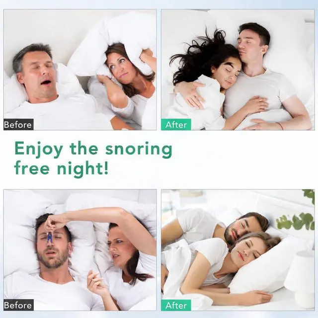 Alt view image 6 of 6 - Anti Snoring Nose Vent 8 Nasal Cones Nasal Dilator to Stop Snoring - Effective Snore Stopper Anti Snoring Devices Easy to Use Snoring Solution