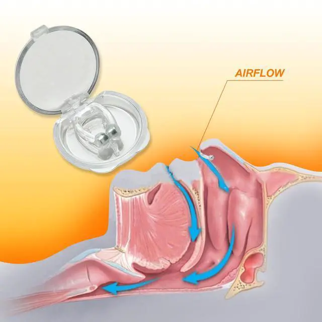 Alt view image 4 of 7 - 30pcs Anti-Snoring Solutions - Nose Vents, Nose Clips, and Nasal Strips - Snore Stopper for Men & Women