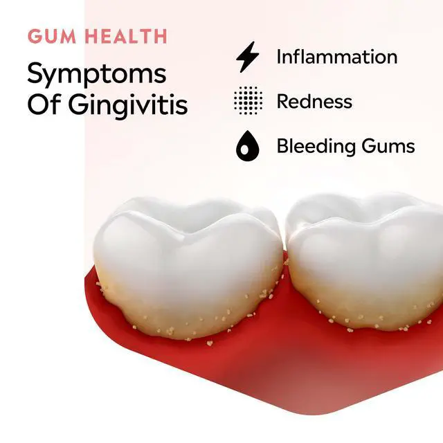 Alt view image 4 of 7 - Clinical Solutions Mouthwash Gum Health Antiseptic, Antigingivitis and Antiplaque Oral Rinse Helps Prevent Buildup and Immediately Kills Germs for Healthier Gums, ICY Mint, 500 mL