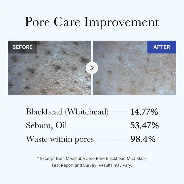Alt view image 5 of 7 - medicube Zero Pore Blackhead Mud Facial Mask - Skin Cooling & Pore Tightening - 3 Minute Quick Dry Formula with AHA, BHA, PHA, and Pore-Purifying Clay - Korean Mud Mask 3.52 oz