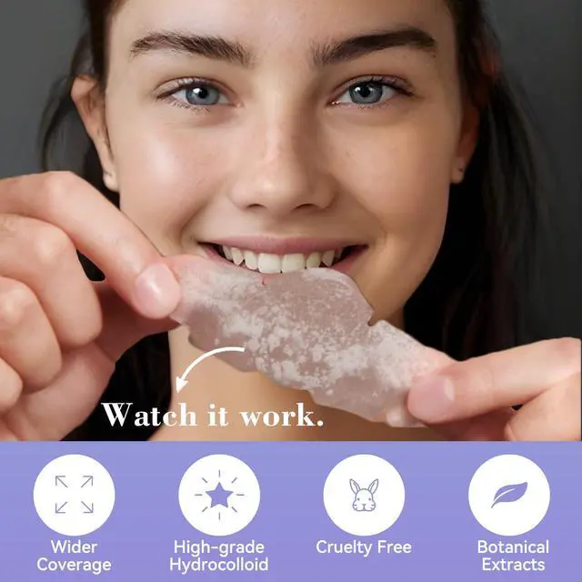 Alt view image 3 of 6 - Vigorder Nose Pore Patches, Hydrocolloid Nose Patches, Targets Pimple, Pores & Oil, Acne Strips to Absorb Acne Gunk Overnight (10 Pack)
