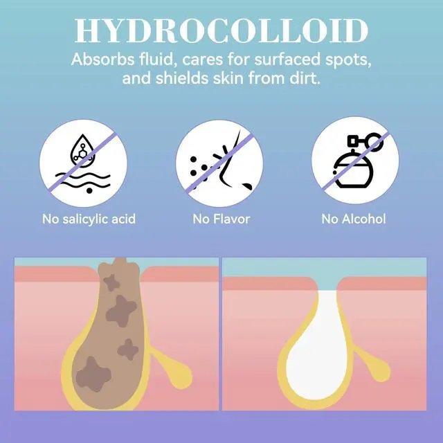 Alt view image 4 of 6 - Vigorder Nose Pore Patches, Hydrocolloid Nose Patches, Targets Pimple, Pores & Oil, Acne Strips to Absorb Acne Gunk Overnight (10 Pack)