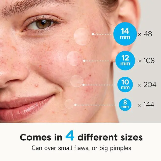 Alt view image 3 of 7 - Glowpatch Pimple Patches for Face (504 Count), FSA Eligible Acne Patch Bulk, Zit Stickers 4 Sizes, Hydrocolloid Spot Stickers, Clear Acne Dots for Covering Zits, Blemishes and Breakouts