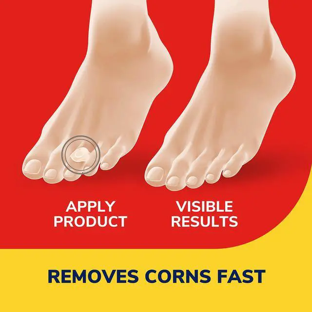 Alt view image 3 of 7 - Dr. Scholl's Corn REMOVERS, 9 Ct // Removes Corns in as Few as 2 Treatments, Maximum Strength, Stays on All Day