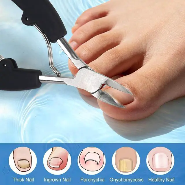 Alt view image 5 of 7 - Ingrown Toenail Clippers, Professional Stainless Steel Toe Nail Clippers