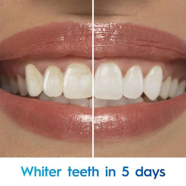 Alt view image 3 of 7 - 3D White Advanced Teeth Whitening Toothpaste, Radiant Mint, 3.3 oz, Pack of 2
