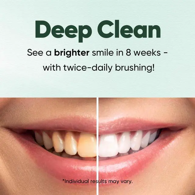 Alt view image 5 of 7 - Fluoride Free Nano Hydroxyapatite Toothpaste for Sensitive Teeth, Strengthens Enamel, Remineralizes & Whitens Teeth, Freshens Breath for Adults, SLS Free, Natural Misty Mint, 4.2 oz