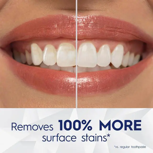 Alt view image 3 of 7 - 3D White Brilliance Blast Teeth Whitening Toothpaste, 4.6 oz, Anticavity Fluoride Toothpaste, 100% More Surface Stain Removal, 24 Hour Active Stain Prevention