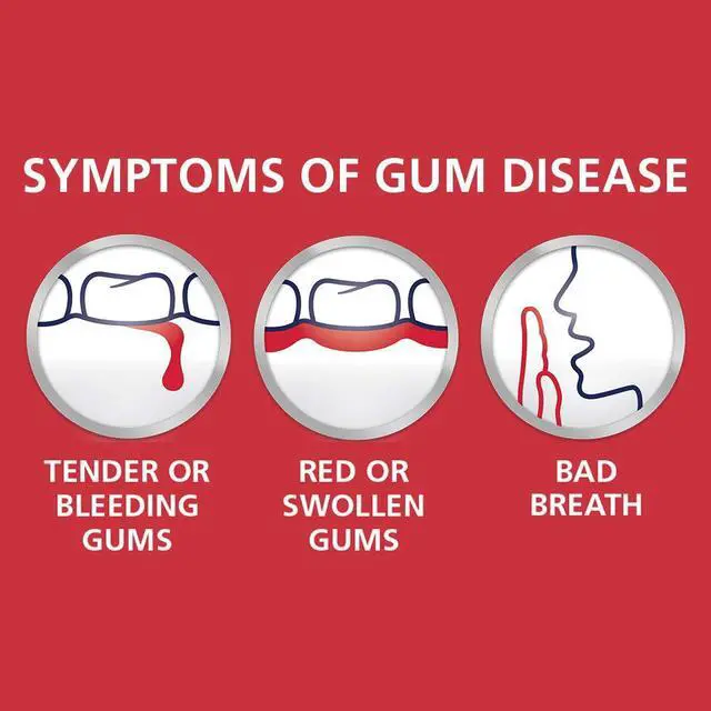 Alt view image 6 of 7 - Toothpaste for Bleeding Gums, Gingivitis Treatment and Cavity Prevention, Clean mint - 3.4 Ounces