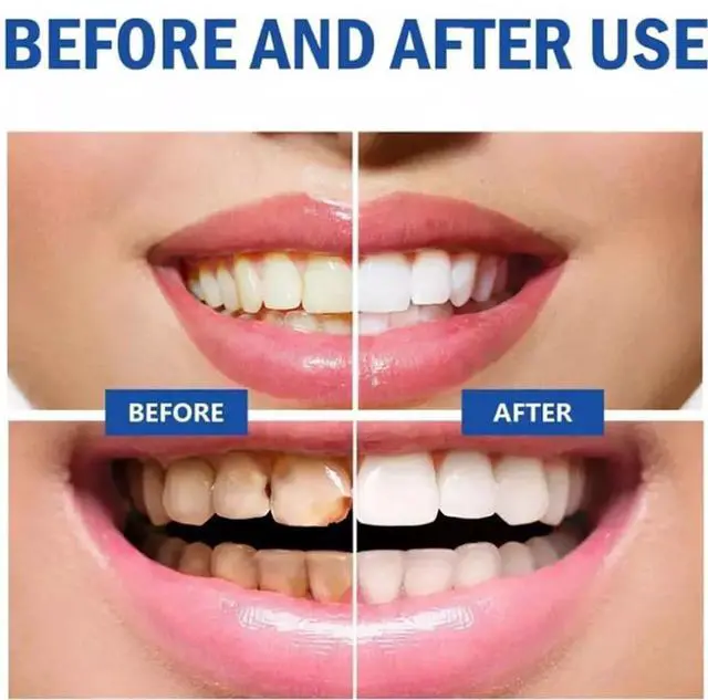Alt view image 6 of 6 - SP 10 Probiotic Toothpaste for Whitening & Gum Health Natural Fluoride-Free Formula for Fresh Breath & Oral Hygiene