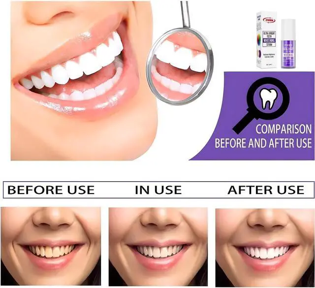 Alt view image 4 of 7 - Purple Toothpaste for Teeth Whitening, Purple Teeth Whitening Gel, Color Corrector, Tooth Stain Removal, Peroxide Free for Sensitive Teeth, 30ml