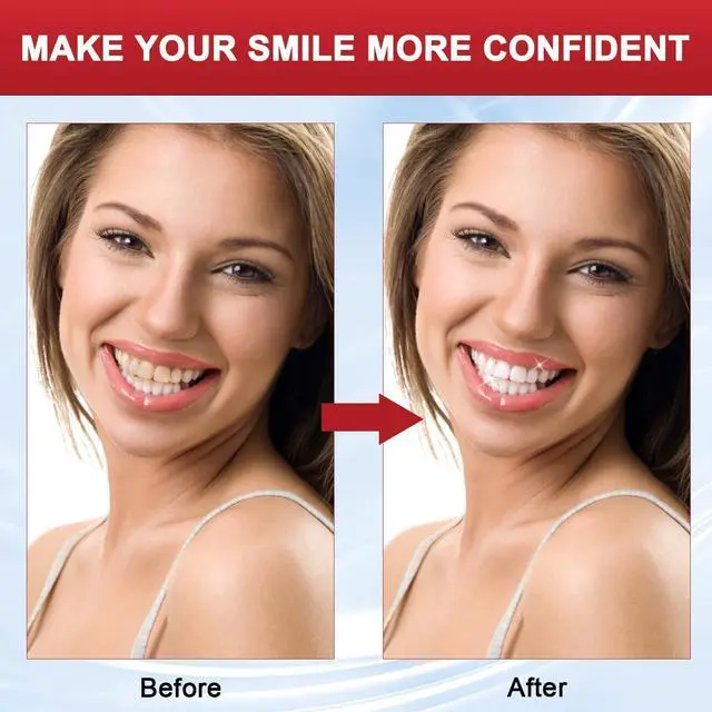 Alt view image 7 of 7 - SP-8 Probiotic Toothpaste, SP8 Toothpaste Fresh Breath, Deep Cleaning Care (01)