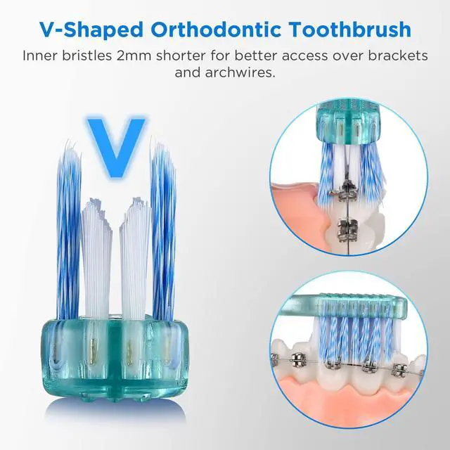 Alt view image 2 of 7 - V-Shaped Orthodontic Toothbrush for Braces, with 6 Interdental Brushes, Soft Bristles, 6 Count