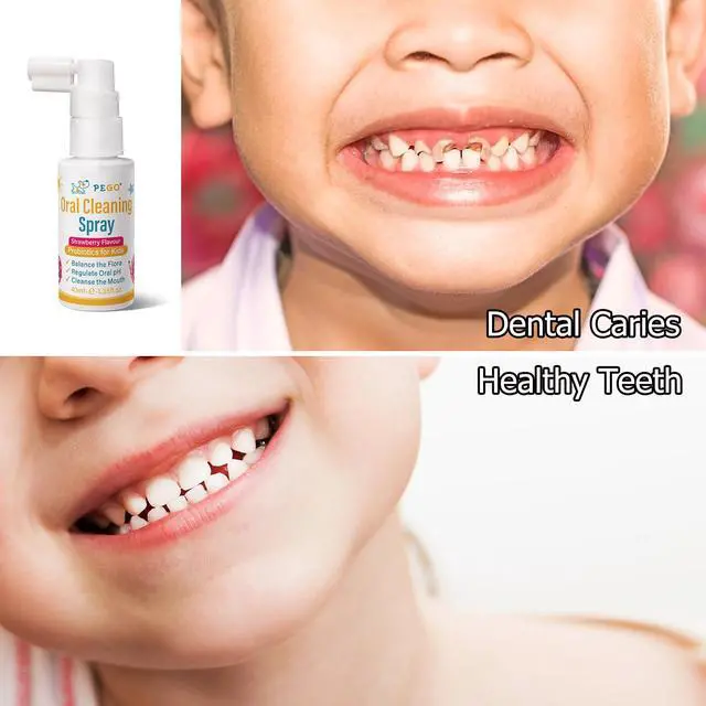 Alt view image 3 of 7 - Kids Oral Spray, Toddler Toothpaste Helper for Cavity Prevention and Fresh Breath, Children Anticavity with Fluoride Free for Newborn to Preschoolers, Kid's Mouth Spray (40ml*1/Pcs)