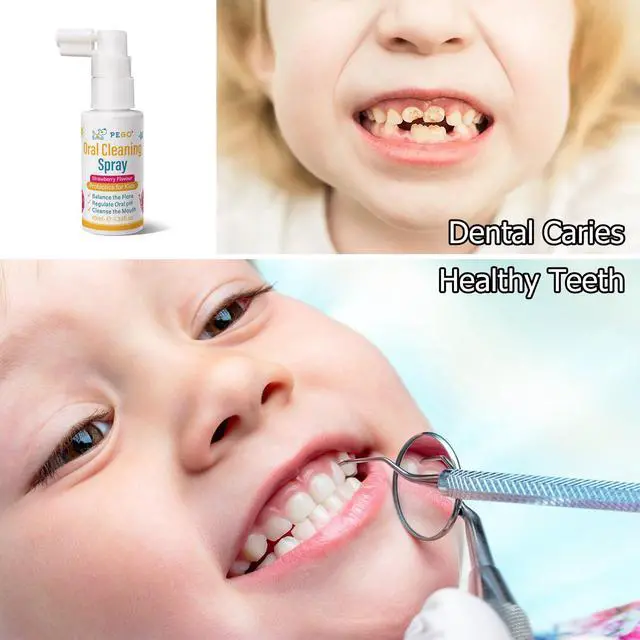 Alt view image 5 of 7 - Kids Oral Spray, Toddler Toothpaste Helper for Cavity Prevention and Fresh Breath, Children Anticavity with Fluoride Free for Newborn to Preschoolers, Kid's Mouth Spray (40ml*1/Pcs)