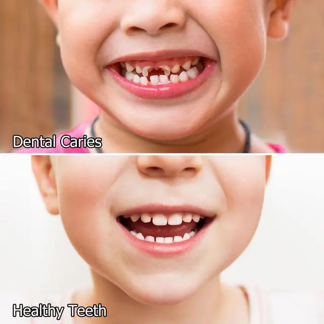 Alt view image 4 of 7 - Kids Oral Spray, Toddler Toothpaste Helper for Cavity Prevention and Fresh Breath, Children Anticavity with Fluoride Free for Newborn to Preschoolers, Kid's Mouth Spray (1)