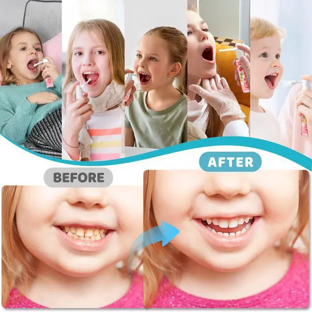 Alt view image 4 of 7 - Kids Oral Spray, 3PCS Toddler Toothpaste Helper for Cavity Repair & Fresh Breath, Kids Probiotic Mouth Spray with Fluoride Free for Newborn to 12 Years 3 FlavorsTotal 3.03fl oz