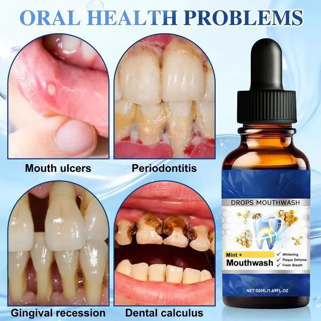 Alt view image 5 of 7 - 2PCS Beetakt Oral Repair Solution, Mint Flavored Oral Mouthwash, Professional Gum Restore Drops, Teeth Restoration, Effectively Improves Oral Hygiene and Freshens Breath