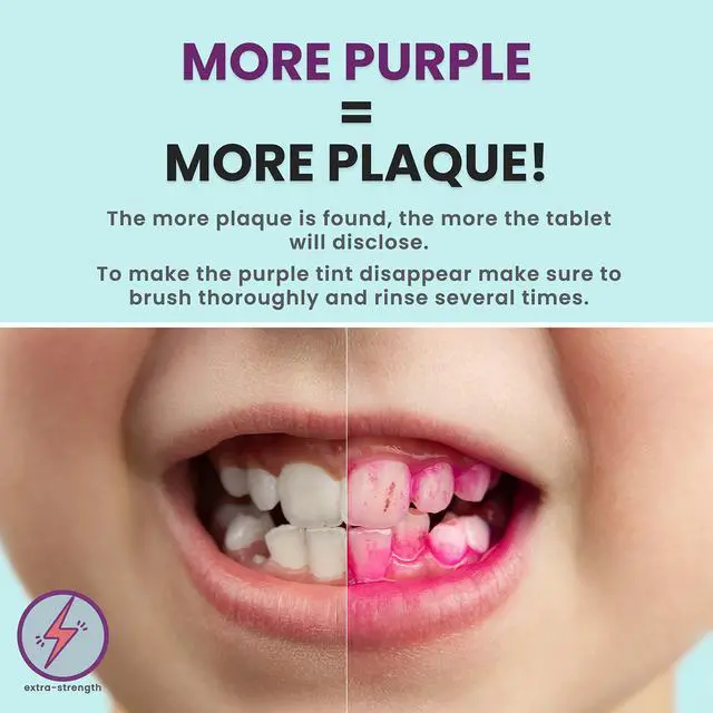 Alt view image 2 of 7 - Plaque Disclosing Tablets for Teeth, 36 Count, Dental Disclosing Tablets for Kids or Adults, Shows Plaque, Helps Teach Kids Teeth-Brushing Habits for Clean Smile, by Fresh Knight, (Pack of 1)