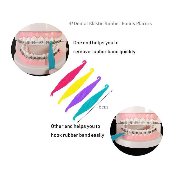 Alt view image 4 of 5 - Oral Care Disassembly Kit/7pcs Including 1 Retainer Case with Mirror and Vent Holes | 1 Aligner Remover Tool | 4 Elastic Rubber Bands Placers | 1 Cleaning Brush (White)