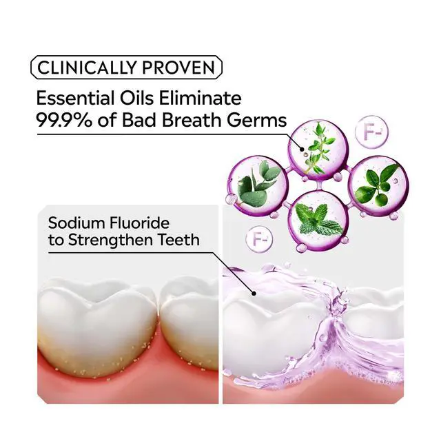 Alt view image 7 of 7 - Mouthwash Total Care Mild Mint Anticavity Treatment for Adults Kills 99.9% of Bad Breath Germs No Burn Alcohol Free Fluoride Mouthwash, 2 Pack of 33.8 fl oz/1 L
