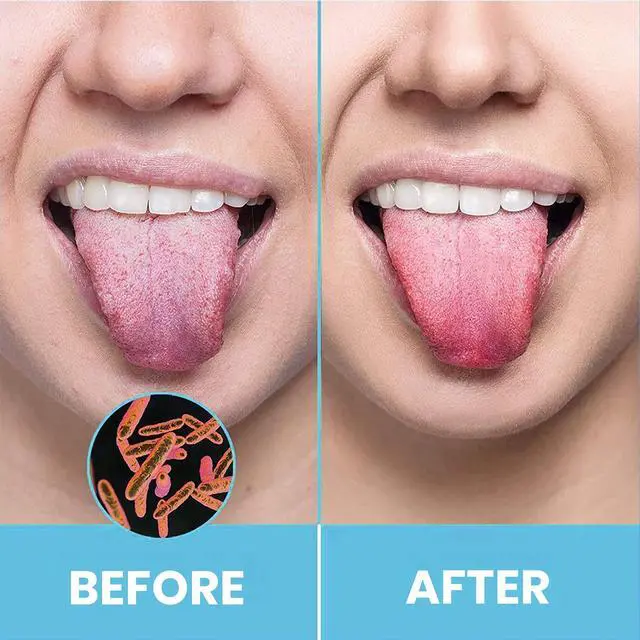 Alt view image 2 of 7 - Tongue Scraper for Adults by (2Pcs Oral Care Pack) Stainless Steel Tongue Cleaners Reduce Bad Breath 100% Metal Tough Scrapers Men and Women Hygiene Product