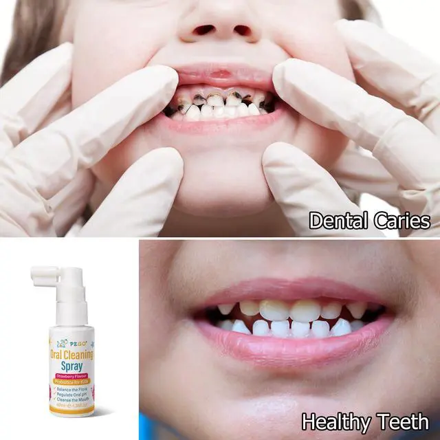 Alt view image 4 of 7 - Kids Oral Spray, Toddler Toothpaste Helper for Cavity Prevention and Fresh Breath, Children Anticavity with Fluoride Free for Newborn to Preschoolers, Kid's Mouth Spray (40ml*2/Pcs)