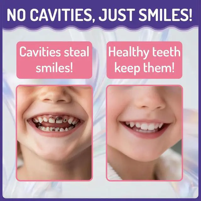 Alt view image 4 of 7 - Kids Oral Spray, Toddler Toothpaste Helper for Cavity Prevention and Fresh Breath, Children Anticavity with Fluoride Free for Newborn to Preschoolers, Kid's Mouth Spray, 40ml/1.35fl.oz (Grape_2P)