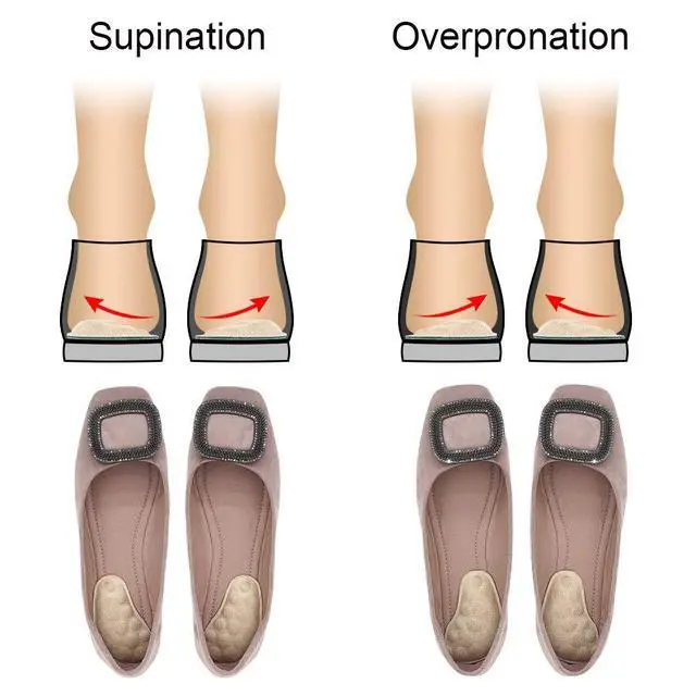 Alt view image 3 of 5 - Supination Insoles & Overpronation Insoles, Medial & Lateral Heel Cups for Foot Alignment, Knee Pain, Bow Legs, Osteoarthritis (Black+Beige)
