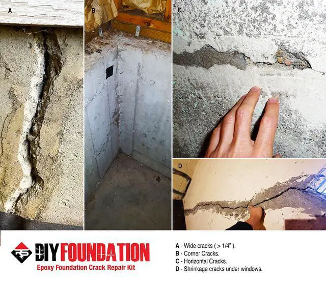 Alt view image 5 of 5 - Epoxy Concrete Crack Repair Kit (10 ft) Low-Viscosity Epoxy Injection for Basement & Foundation Walls Structural Crack Repair System