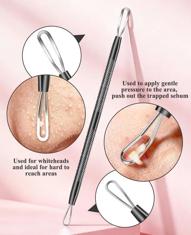 Alt view image 3 of 7 - 3PCS Pimple Extractor Acne Treatment Tool Professional Stainless Blackhead Comedone Removal Popper Tool for Face Nose Blackhead Extractor Tool (Black)