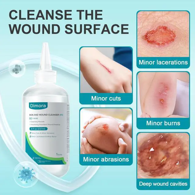 Alt view image 2 of 7 - Wound Cleanser Skin Rinsing Wash First Aid Solution 8 oz