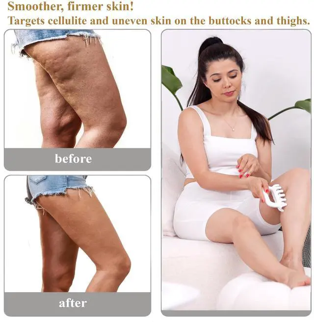 Alt view image 3 of 6 - Fascia Massage Tool Trigger Point Massage Tools Anti Blaster for Cellulite Massager Tool Reaching Deep Myofascial Tissue Throughout The Body Release Muscle Knot Reduction Cellulite
