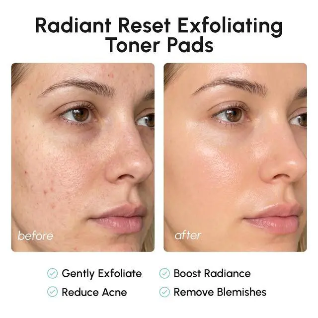 Alt view image 5 of 7 - Glycolic Acid Pads - Toner Pads for Face Cleansing - Exfoliating Pad with Tea Tree Oil, Salicylic Acid & Vitamins E, B3, B5 - Facial Polishes & Peels, Skin Pore Resurfacing & Radiance - 50 Count