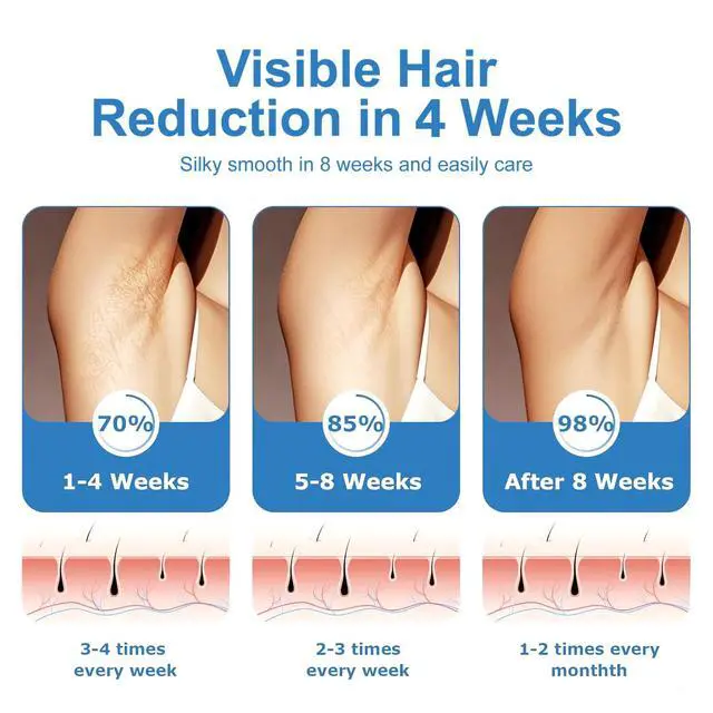 Alt view image 7 of 7 - IPL Hair Removal,Laser Hair Removal,hair removal device,Permanent Hair Removal With Ice-Cooling,At-Home Hair Remover,Painless & Long-Lasting Results,Holiday gifts for women and men.