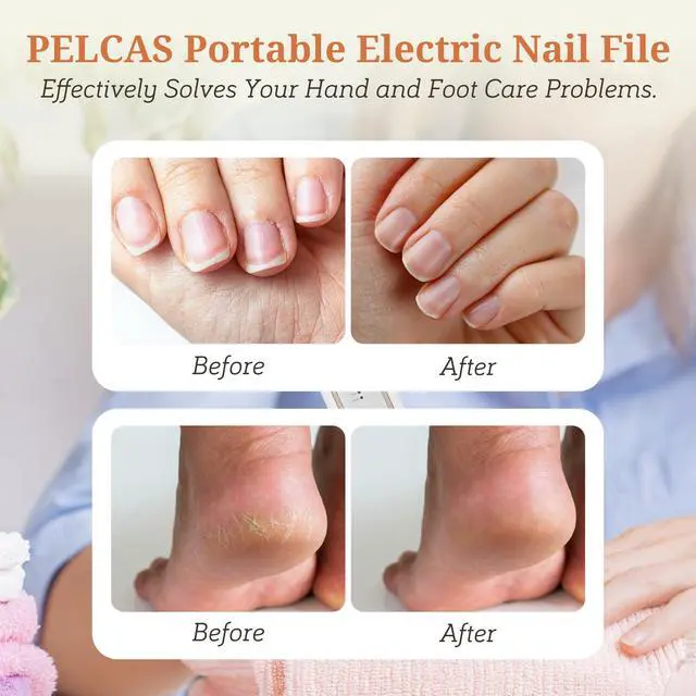 Alt view image 2 of 7 - Electric Toenail Grinder for Thick Toenails, 5 Speeds & LED Light
