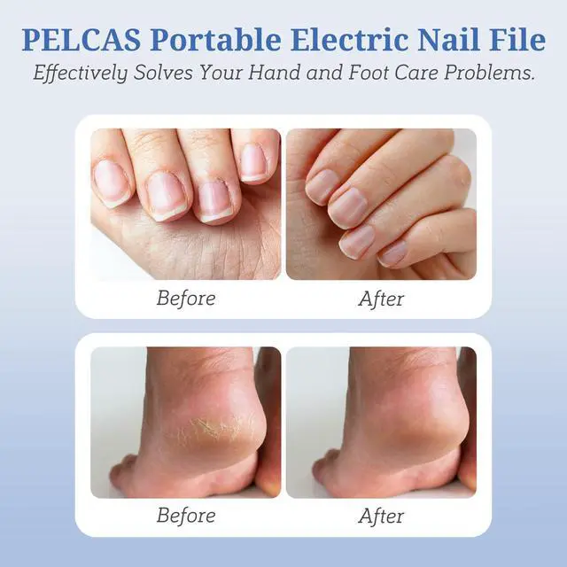 Alt view image 2 of 7 - Electric Nail File, Manicure and Pedicure Kit 5 Speeds & LED Light