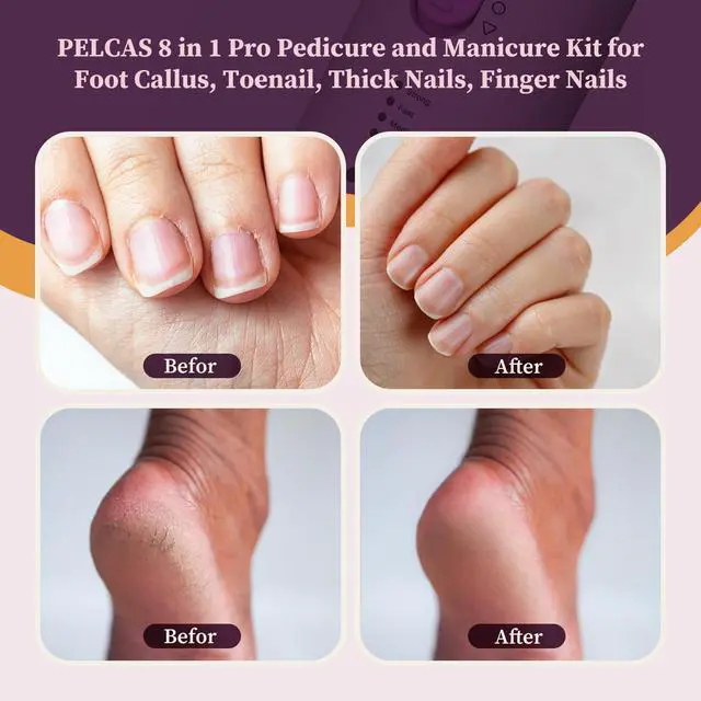 Alt view image 2 of 7 - Toenail Grinder for Thick Toenails 8 in 1 Manicure & Pedicure Kit