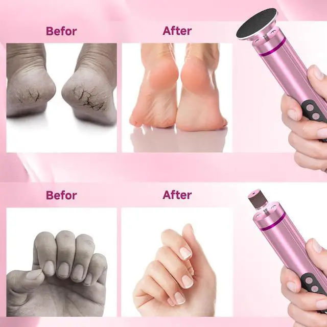 Alt view image 3 of 7 - Electric Foot Nail File Cordless, 2 in 1 Wireless Dermave Electric Foot Callus Remover, Adjustable 9 Speed Rechargeable Pedicure Foot Filer Tool w/Sandpaper Discs & Nail Drill Bits,Digital Display