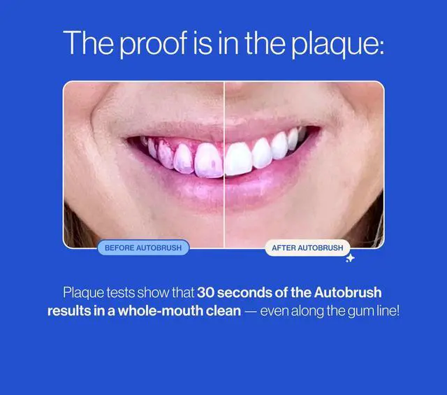 Alt view image 7 of 7 - Sonic Pro Electric Toothbrush Only ADA Accepted U-Shaped Brush, Clinically Proven Up to 5.1X Better Cleaning, 30-Second Full Mouth 360 Clean, Rechargeable, Waterproof, Black, Men's Regular
