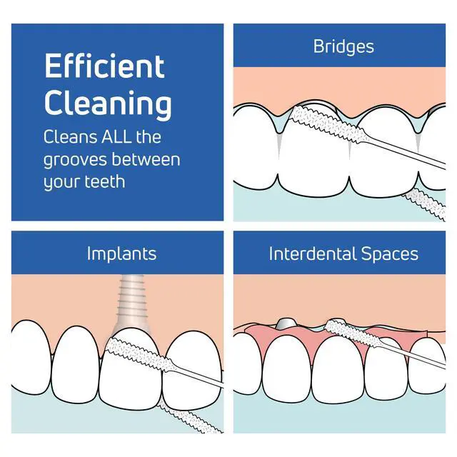 Alt view image 3 of 6 - Bridge and Implant Floss for Dental Implants, Bridges, and Braces, Dental Flossers, 30 Pieces