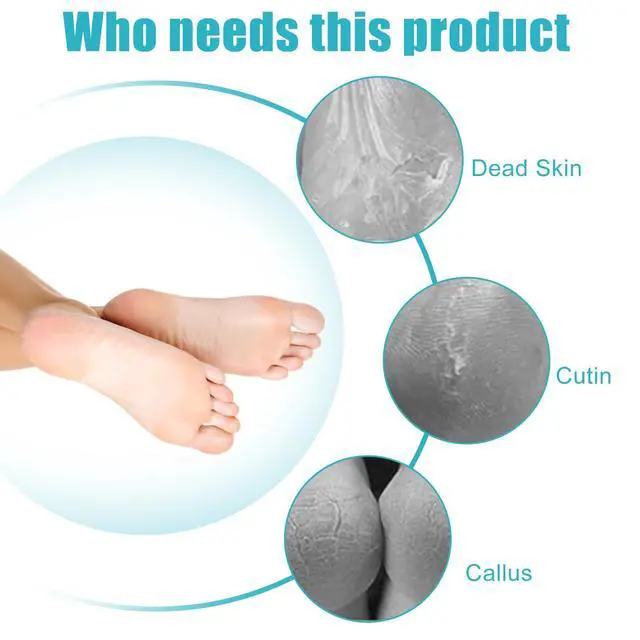 Alt view image 6 of 6 - Foot File Callus Remover-2 Pcs 4 in 1 Foot Scrubber Dead Skin Remover for Feet,Pumice Stone, Foot Rasp and Sand Paper for Home Foot Care,Foot Brush for Shower (Grey Pedicure Foot File)